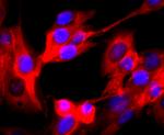 VAMP2 Antibody in Immunocytochemistry (ICC/IF)