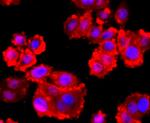 VCP Antibody in Immunocytochemistry (ICC/IF)