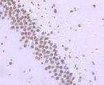 Phospho-RNA pol II CTD (Ser2) Antibody in Immunohistochemistry (Paraffin) (IHC (P))