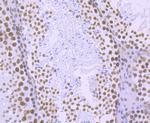 Phospho-RNA pol II CTD (Ser2) Antibody in Immunohistochemistry (Paraffin) (IHC (P))