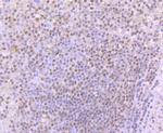 53BP1 Antibody in Immunohistochemistry (Paraffin) (IHC (P))