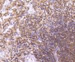 ITGA4 Antibody in Immunohistochemistry (Paraffin) (IHC (P))