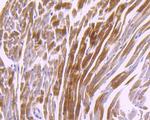 CaMKII delta Antibody in Immunohistochemistry (Paraffin) (IHC (P))