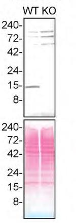 Profilin 1 Antibody