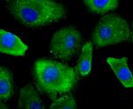 Profilin 1 Antibody in Immunocytochemistry (ICC/IF)