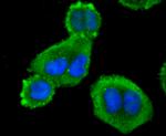 Profilin 1 Antibody in Immunocytochemistry (ICC/IF)