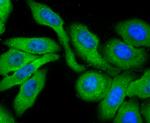 Profilin 1 Antibody in Immunocytochemistry (ICC/IF)