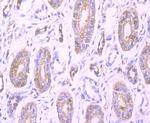 Profilin 1 Antibody in Immunohistochemistry (Paraffin) (IHC (P))