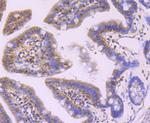 Profilin 1 Antibody in Immunohistochemistry (Paraffin) (IHC (P))