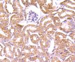 Profilin 1 Antibody in Immunohistochemistry (Paraffin) (IHC (P))