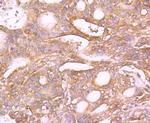 MUC4 Antibody in Immunohistochemistry (Paraffin) (IHC (P))