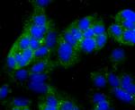 NDRG1 Antibody in Immunocytochemistry (ICC/IF)