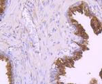 NDRG1 Antibody in Immunohistochemistry (Paraffin) (IHC (P))