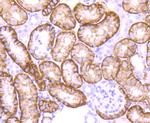 NDRG1 Antibody in Immunohistochemistry (Paraffin) (IHC (P))