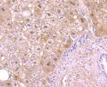 Protein C Antibody in Immunohistochemistry (Paraffin) (IHC (P))