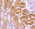 Protein C Antibody in Immunohistochemistry (Paraffin) (IHC (P))