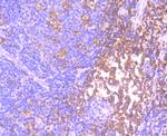 ID1 Antibody in Immunohistochemistry (Paraffin) (IHC (P))