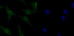 Phospho-ATM (Ser1981) Antibody in Immunocytochemistry (ICC/IF)