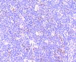 Phospho-ATM (Ser1981) Antibody in Immunohistochemistry (Paraffin) (IHC (P))