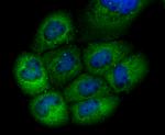 GCLM Antibody in Immunocytochemistry (ICC/IF)