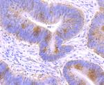 GCLM Antibody in Immunohistochemistry (Paraffin) (IHC (P))