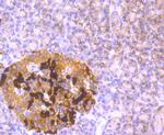 GCLM Antibody in Immunohistochemistry (Paraffin) (IHC (P))