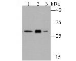 GCLM Antibody in Western Blot (WB)