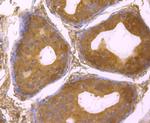 USP14 Antibody in Immunohistochemistry (Paraffin) (IHC (P))