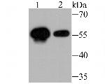 USP14 Antibody in Western Blot (WB)