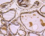 B-Raf Antibody in Immunohistochemistry (Paraffin) (IHC (P))