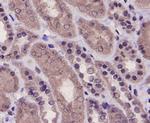 PRMT5 Antibody in Immunohistochemistry (Paraffin) (IHC (P))