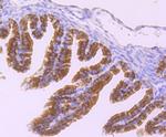 DNAI1 Antibody in Immunohistochemistry (Paraffin) (IHC (P))