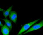 C19orf35 Antibody in Immunocytochemistry (ICC/IF)