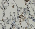 C19orf35 Antibody in Immunohistochemistry (Paraffin) (IHC (P))