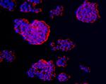 CCDC47 Antibody in Immunocytochemistry (ICC/IF)