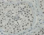 CCDC47 Antibody in Immunohistochemistry (Paraffin) (IHC (P))