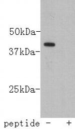 Lass2 Antibody in Western Blot (WB)