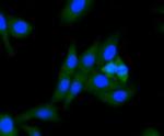 ALDH2 Antibody in Immunocytochemistry (ICC/IF)