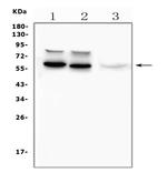 Tyrosine Hydroxylase Antibody in Western Blot (WB)