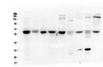 Arylsulfatase A Antibody in Western Blot (WB)