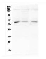 Arylsulfatase A Antibody in Western Blot (WB)