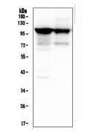 alpha Actinin 3 Antibody in Western Blot (WB)