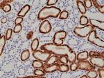 NAPSA Antibody in Immunohistochemistry (Paraffin) (IHC (P))