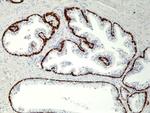 Cytokeratin 5/6 Antibody in Immunohistochemistry (Paraffin) (IHC (P))