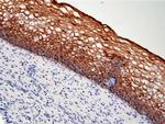 Cytokeratin 5/6 Antibody in Immunohistochemistry (Paraffin) (IHC (P))