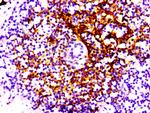 CD21 Antibody in Immunohistochemistry (Paraffin) (IHC (P))