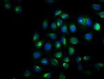 Phospho-IRE1 alpha (Ser724) Antibody in Immunocytochemistry (ICC/IF)