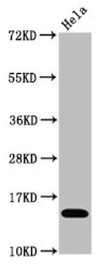 H3K4ac Antibody in Western Blot (WB)