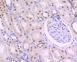 PTBP1 Antibody in Immunohistochemistry (Paraffin) (IHC (P))