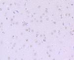 DKC1 Antibody in Immunohistochemistry (Paraffin) (IHC (P))